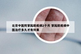 北京中医院掌跖脓疱病2个月 掌跖脓疱病中医治疗多久才有效果