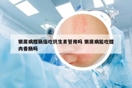 银屑病腊肠指吃抗生素管用吗 银屑病能吃腊肉香肠吗