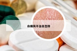 白癜风不治会怎样