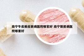 南宁牛皮癣皮肤病医院哪家好 南宁银屑病医院哪里好