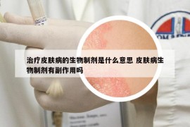 治疗皮肤病的生物制剂是什么意思 皮肤病生物制剂有副作用吗