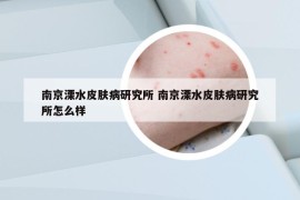 南京溧水皮肤病研究所 南京溧水皮肤病研究所怎么样