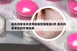 英夫利昔单抗诱发脓疱型银屑病1例 英夫利昔单抗的作用机制