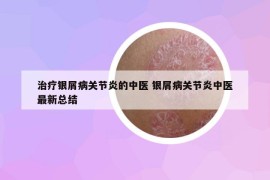 治疗银屑病关节炎的中医 银屑病关节炎中医最新总结