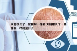 大腿根长了一些像癣一样的 大腿根长了一些像癣一样的是什么