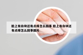 脸上有白块还有点痒怎么回事 脸上有白块还有点痒怎么回事图片