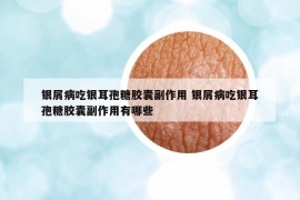 银屑病吃银耳孢糖胶囊副作用 银屑病吃银耳孢糖胶囊副作用有哪些