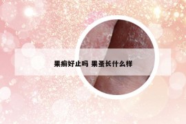 果癣好止吗 果蚤长什么样