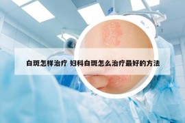 白斑怎样治疗 妇科白斑怎么治疗最好的方法