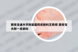 西安交通大学附属医院皮肤科王教授 西安交大附一皮肤科