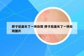 脖子后面长了一块白斑 脖子后面长了一块白斑图片