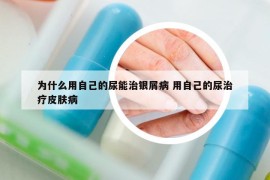 为什么用自己的尿能治银屑病 用自己的尿治疗皮肤病