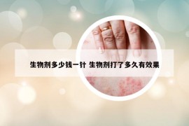 生物剂多少钱一针 生物剂打了多久有效果