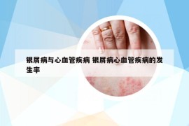 银屑病与心血管疾病 银屑病心血管疾病的发生率