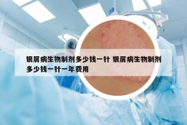 银屑病生物制剂多少钱一针 银屑病生物制剂多少钱一针一年费用