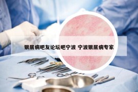 银屑病吧友论坛吧宁波 宁波银屑病专家