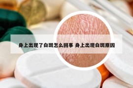 身上出现了白斑怎么回事 身上出现白斑原因