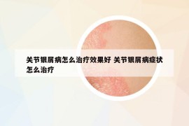 关节银屑病怎么治疗效果好 关节银屑病症状怎么治疗