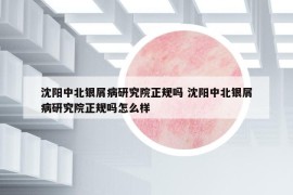 沈阳中北银屑病研究院正规吗 沈阳中北银屑病研究院正规吗怎么样