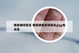 银屑病球蛋百 银屑病免疫球蛋白gigg有点高