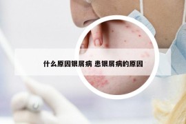 什么原因银屑病 患银屑病的原因