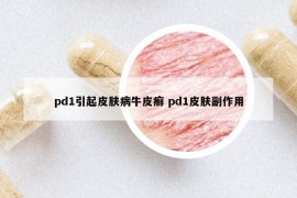 pd1引起皮肤病牛皮癣 pd1皮肤副作用