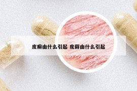 皮癣由什么引起 皮藓由什么引起