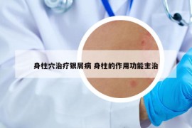 身柱穴治疗银屑病 身柱的作用功能主治