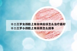 十二三岁女孩脸上有白块应该怎么治疗最好 十二三岁小孩脸上有白斑怎么回事