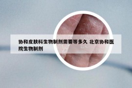 协和皮肤科生物制剂需要等多久 北京协和医院生物制剂
