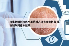 打生物制剂阿达木单抗对人体有哪些伤害 生物制剂阿达木效果