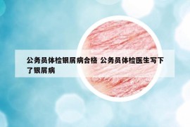 公务员体检银屑病合格 公务员体检医生写下了银屑病