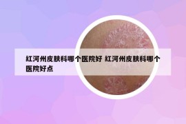 红河州皮肤科哪个医院好 红河州皮肤科哪个医院好点