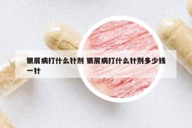 银屑病打什么针剂 银屑病打什么针剂多少钱一针