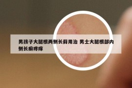 男孩子大腿根两侧长藓用治 男士大腿根部内侧长癣疼痒