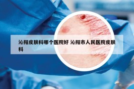 沁阳皮肤科哪个医院好 沁阳市人民医院皮肤科