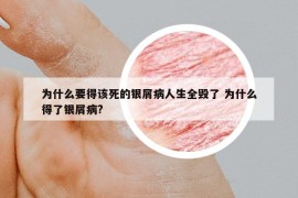 为什么要得该死的银屑病人生全毁了 为什么得了银屑病?