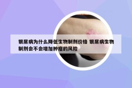 银屑病为什么降低生物制剂价格 银屑病生物制剂会不会增加肿瘤的风险