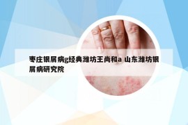 枣庄银屑病g经典潍坊王尚和a 山东潍坊银屑病研究院