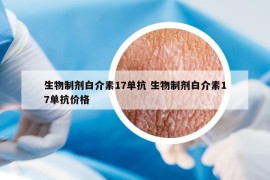 生物制剂白介素17单抗 生物制剂白介素17单抗价格