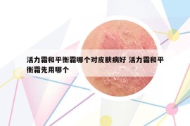 活力霜和平衡霜哪个对皮肤病好 活力霜和平衡霜先用哪个