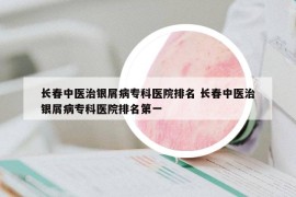 长春中医治银屑病专科医院排名 长春中医治银屑病专科医院排名第一