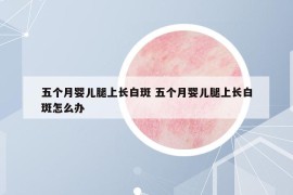 五个月婴儿腿上长白斑 五个月婴儿腿上长白斑怎么办