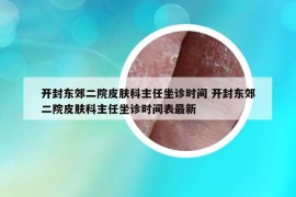 开封东郊二院皮肤科主任坐诊时间 开封东郊二院皮肤科主任坐诊时间表最新