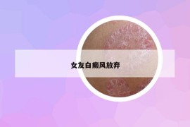 女友白癜风放弃