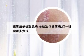 银屑病单抗致患吗 单抗治疗银屑病,打一针需要多少钱