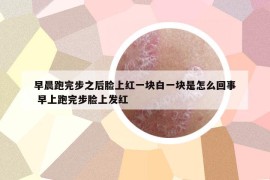 早晨跑完步之后脸上红一块白一块是怎么回事 早上跑完步脸上发红