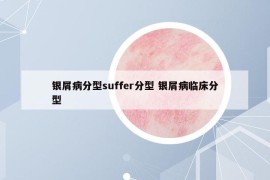 银屑病分型suffer分型 银屑病临床分型