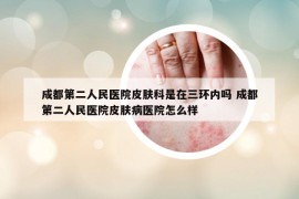 成都第二人民医院皮肤科是在三环内吗 成都第二人民医院皮肤病医院怎么样