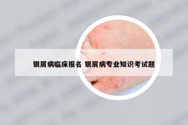 银屑病临床报名 银屑病专业知识考试题